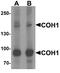 Vacuolar protein sorting-associated protein 13B antibody, A04566, Boster Biological Technology, Western Blot image 