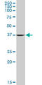 Aldolase, Fructose-Bisphosphate A antibody, LS-B6377, Lifespan Biosciences, Western Blot image 