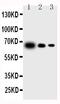 Interleukin 23 Subunit Alpha antibody, PA1470, Boster Biological Technology, Western Blot image 