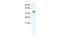 Apoptosis Antagonizing Transcription Factor antibody, 27-426, ProSci, Immunohistochemistry paraffin image 