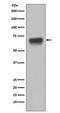 CD86 antibody, M00220-1, Boster Biological Technology, Western Blot image 