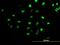 Centromere Protein H antibody, H00064946-B02P, Novus Biologicals, Immunocytochemistry image 