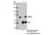 Neurofibromin 2 antibody, 12896S, Cell Signaling Technology, Immunoprecipitation image 