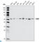 Checkpoint Kinase 2 antibody, LS-C814008, Lifespan Biosciences, Immunofluorescence image 