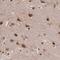 Glyoxylate Reductase 1 Homolog antibody, PA5-61690, Invitrogen Antibodies, Immunohistochemistry frozen image 