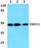 Thyroid Hormone Receptor Interactor 13 antibody, PA5-75575, Invitrogen Antibodies, Western Blot image 