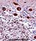 Neuronal Calcium Sensor 1 antibody, abx028150, Abbexa, Western Blot image 