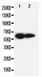 Interleukin 2 Receptor Subunit Beta antibody, PA1615, Boster Biological Technology, Western Blot image 