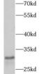 CD8 antibody, FNab09850, FineTest, Western Blot image 