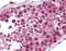 Histone Deacetylase 6 antibody, NBP1-69127, Novus Biologicals, Immunohistochemistry paraffin image 
