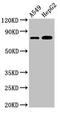TBC1 Domain Family Member 15 antibody, CSB-PA823452LA01HU, Cusabio, Western Blot image 