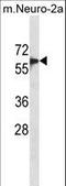 SMAD Family Member 6 antibody, LS-C156110, Lifespan Biosciences, Western Blot image 