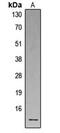 Defensin Alpha 1B antibody, MBS8231082, MyBioSource, Western Blot image 