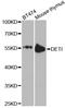 DET1 homolog antibody, A9974, ABclonal Technology, Western Blot image 