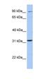 Extracellular Leucine Rich Repeat And Fibronectin Type III Domain Containing 2 antibody, orb325560, Biorbyt, Western Blot image 