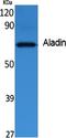 Aladin WD Repeat Nucleoporin antibody, A01336, Boster Biological Technology, Western Blot image 