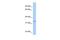 Glutathione S-Transferase Omega 2 antibody, GTX46115, GeneTex, Western Blot image 
