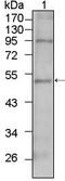 T-Box 5 antibody, GTX83374, GeneTex, Western Blot image 