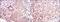 Mitogen-Activated Protein Kinase Kinase 6 antibody, NBP2-37637, Novus Biologicals, Immunohistochemistry frozen image 