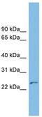 Thymocyte Nuclear Protein 1 antibody, TA334500, Origene, Western Blot image 