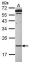 Transmembrane P24 Trafficking Protein 2 antibody, PA5-22385, Invitrogen Antibodies, Western Blot image 