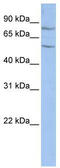 T-Complex-Associated-Testis-Expressed 1 antibody, TA337596, Origene, Western Blot image 