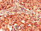 Proteasome 26S Subunit, Non-ATPase 2 antibody, CSB-PA619755LA01HU, Cusabio, Immunohistochemistry paraffin image 