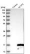 Acylphosphatase 2 antibody, PA5-57216, Invitrogen Antibodies, Western Blot image 