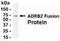 Adrenoceptor Beta 2 antibody, NB120-13989, Novus Biologicals, Western Blot image 