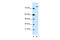 Zinc Finger MYM-Type Containing 3 antibody, 28-115, ProSci, Western Blot image 