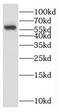 Cytochrome P450 4A11 antibody, FNab02168, FineTest, Western Blot image 
