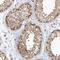 Proteasome 26S Subunit, Non-ATPase 6 antibody, NBP1-81545, Novus Biologicals, Immunohistochemistry paraffin image 