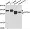 Glutathione S-Transferase Mu 4 antibody, LS-C349137, Lifespan Biosciences, Western Blot image 