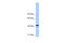 Phosphoglycerate Kinase 1 antibody, 30-362, ProSci, Western Blot image 