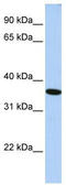General Transcription Factor IIA Subunit 1 antibody, TA344434, Origene, Western Blot image 