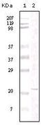 Protein Tyrosine Kinase 2 antibody, MA5-15282, Invitrogen Antibodies, Western Blot image 