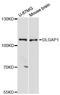 DLG Associated Protein 1 antibody, A13060, ABclonal Technology, Western Blot image 