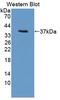 Glycogen Synthase Kinase 3 Alpha antibody, LS-C372567, Lifespan Biosciences, Western Blot image 