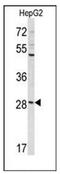 Coiled-coil domain-containing protein 85B antibody, AP51264PU-N, Origene, Western Blot image 