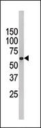 Far upstream element-binding protein 3 antibody, 60-358, ProSci, Western Blot image 