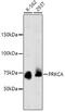 Protein Kinase C Alpha antibody, 13-914, ProSci, Western Blot image 