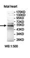 Immunoglobulin Superfamily Containing Leucine Rich Repeat antibody, orb78039, Biorbyt, Western Blot image 