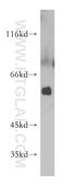 Succinyl-CoA:Glutarate-CoA Transferase antibody, 21589-1-AP, Proteintech Group, Western Blot image 