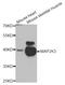 Mitogen-Activated Protein Kinase Kinase 3 antibody, STJ110029, St John