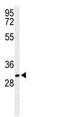 Brain Abundant Membrane Attached Signal Protein 1 antibody, ab103315, Abcam, Western Blot image 