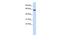 Leucine Rich Repeat And Ig Domain Containing 4 antibody, GTX46712, GeneTex, Western Blot image 