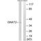 G Protein Subunit Alpha Transducin 2 antibody, A06518, Boster Biological Technology, Western Blot image 