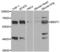 Bestrophin 1 antibody, LS-C335598, Lifespan Biosciences, Western Blot image 