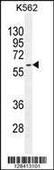 Keratin 73 antibody, 55-735, ProSci, Western Blot image 