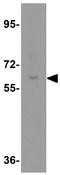 Catenin Beta Like 1 antibody, GTX17099, GeneTex, Western Blot image 